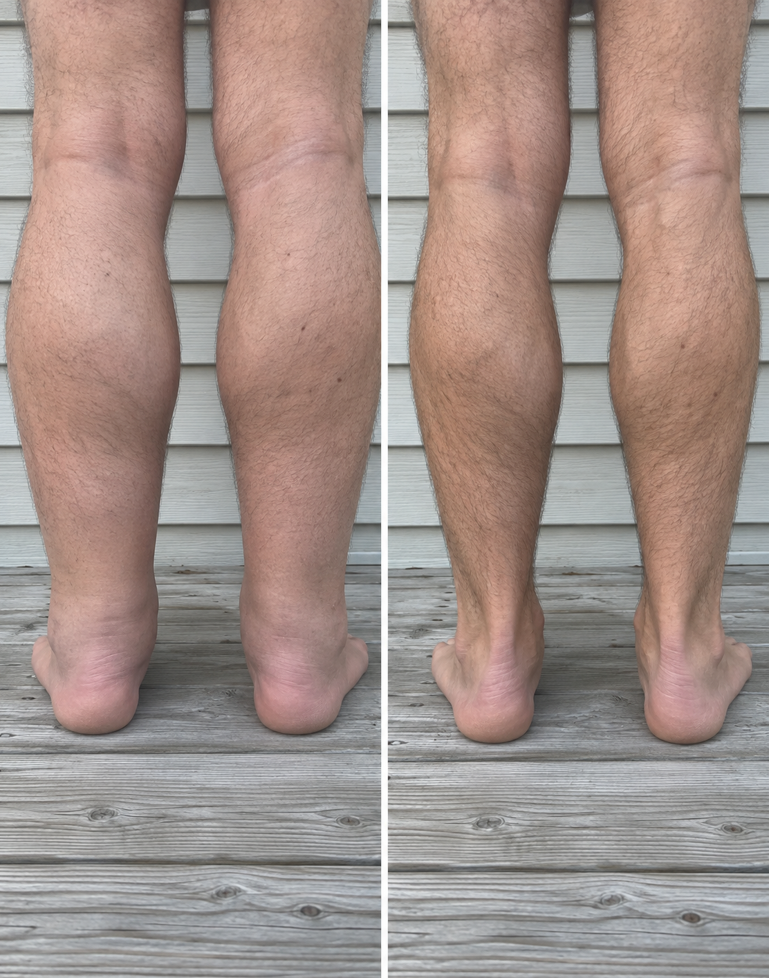 Before: February 2 → After: March 30